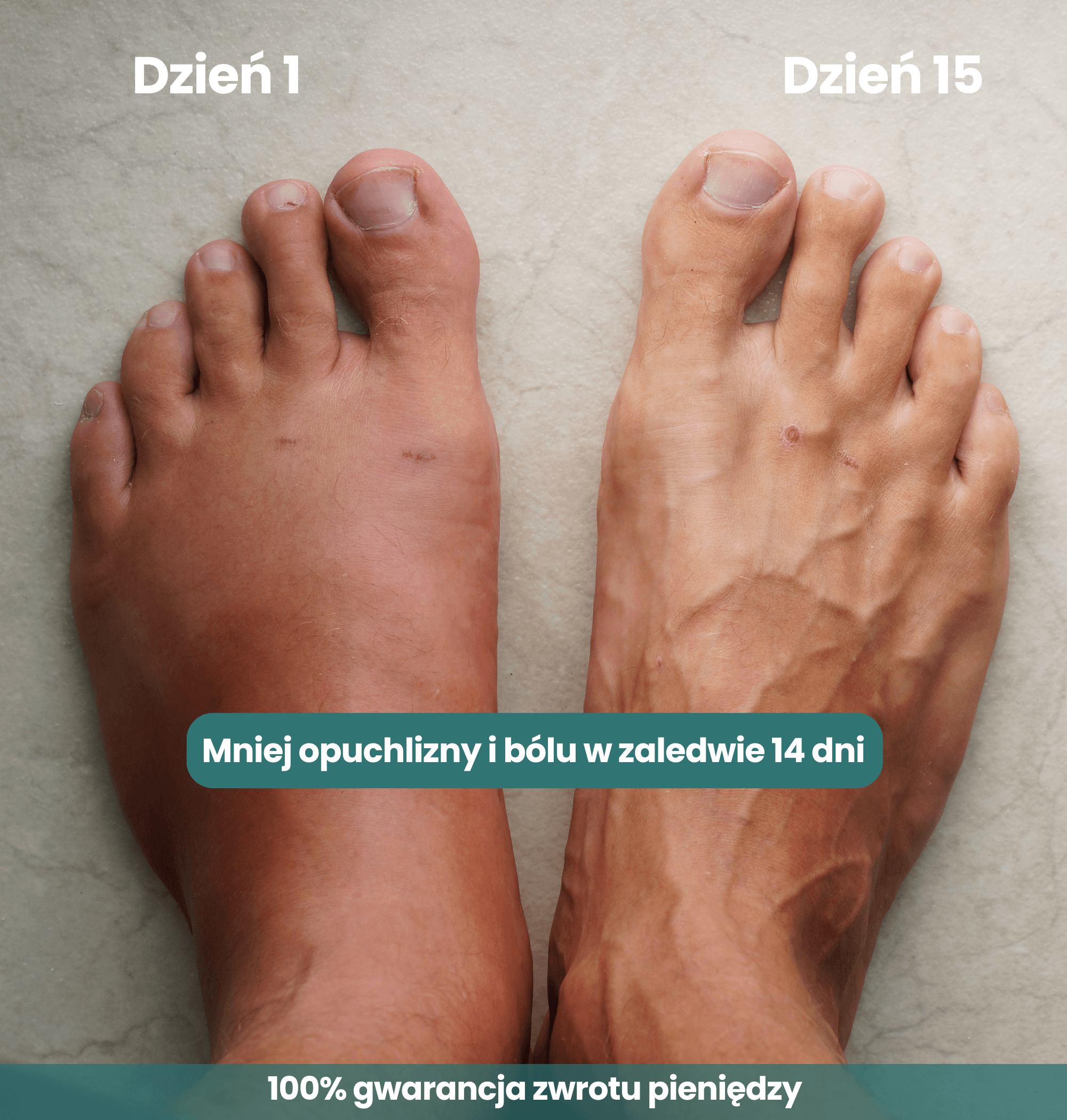 Venofit - skarpetki kompresyjne dla zdrowych nóg